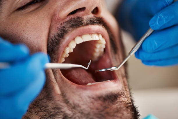 Best Full Mouth Reconstruction  in Grasonville, MD